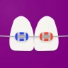 เครื่องมือจัดฟัน BraceMate