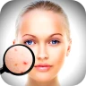 Face Enhancer: Blemish Remover