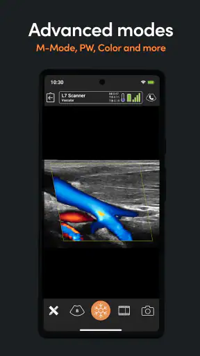 Clarius Ultrasound screenshot