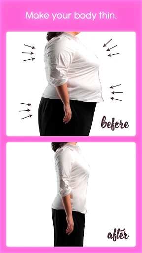 عملية تجميل الأنف screenshot