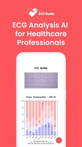 ECG Buddy | ECG Analysis AI screenshot