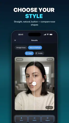 Nose Job - Plastic Surgery AI screenshot