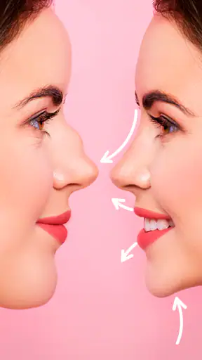 Rhinoplasty App: Nose Editor screenshot