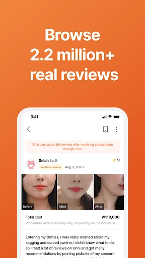 UNNI: Plastic Surgery & Beauty screenshot