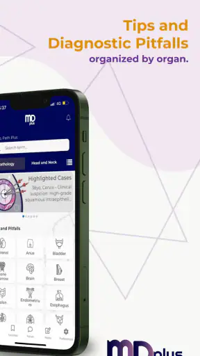 MD Plus screenshot