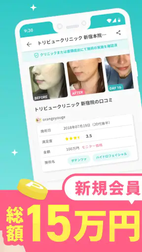 トリビュー（美容 医療の口コミ予約アプリ） screenshot