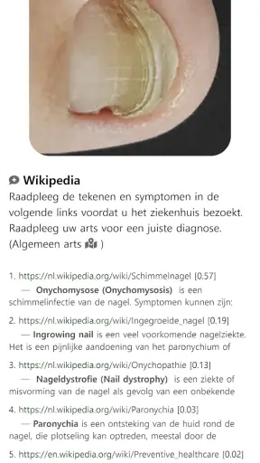 Model Dermatol – Huidziekte screenshot