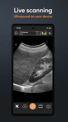 App de Ultrassom Clarius screenshot