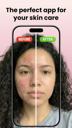 Skin Care Scanner: GlowUp screenshot