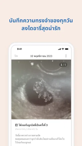 Baby Billy - ตั้งครรภ์&ลูกน้อย screenshot