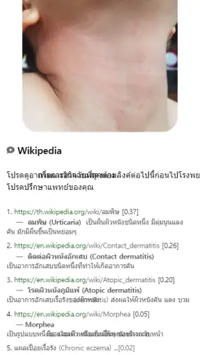 Model Dermatol – โรคผิวหนัง screenshot